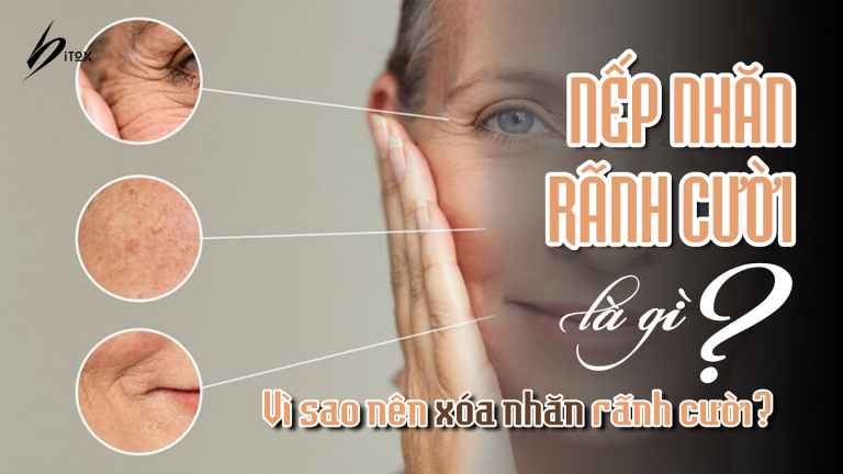 Top 5 cách xoá nhăn rãnh cười hiệu quả nhất