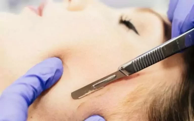 Có nên cạo lông mặt không? Những điều bạn cần biết để cạo lông mặt đúng cách