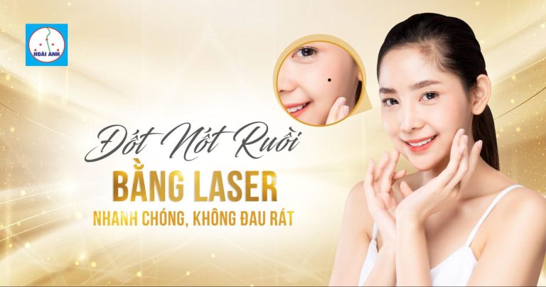 TẨY NỐT RUỒI BẰNG LASER NHANH CHÓNG, KHÔNG ĐAU RÁT