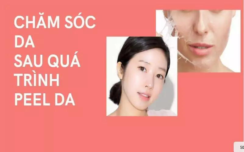 chăm sóc da sau peel