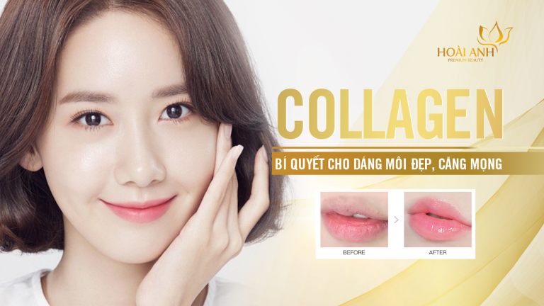 PHUN MÔI COLLAGEN – BÍ QUYẾT CHO DÁNG MÔI ĐẸP, CĂNG MỌNG